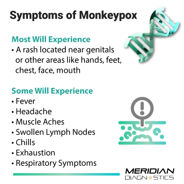Symptoms of Monkeypox
