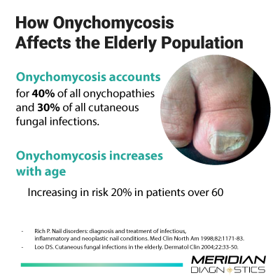 Onymychosis in the elderly