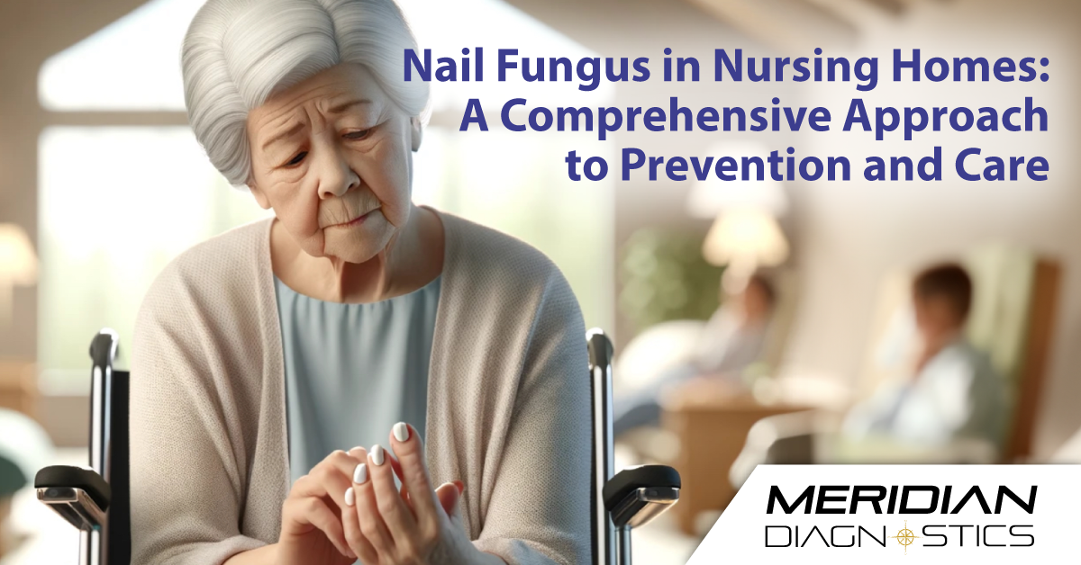 Facing nursing home nail fungus issues